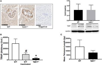 Telomerase Deficiency Predisposes to Heart Failure and Ischemia-Reperfusion Injury